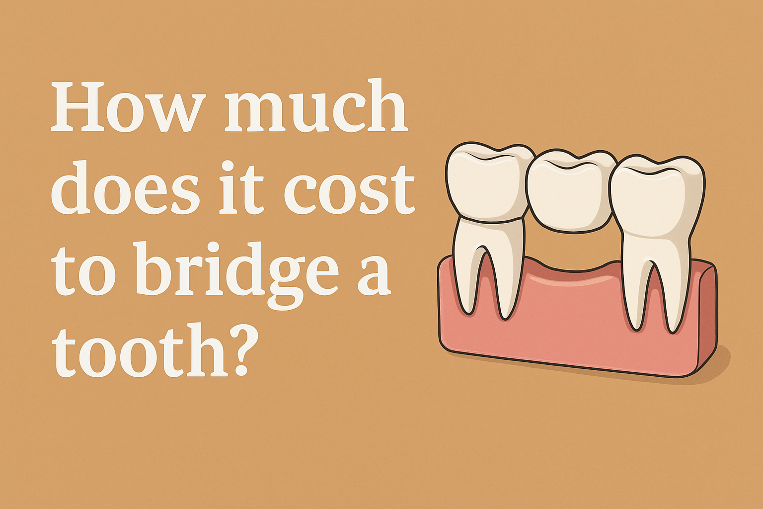 How much does it cost to bridge a tooth
