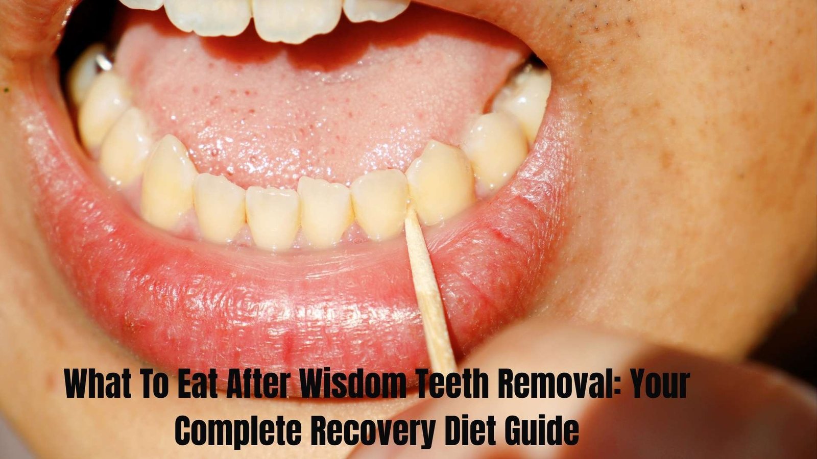 What To Eat After Wisdom Teeth Removal: Your Complete Recovery Diet Guide